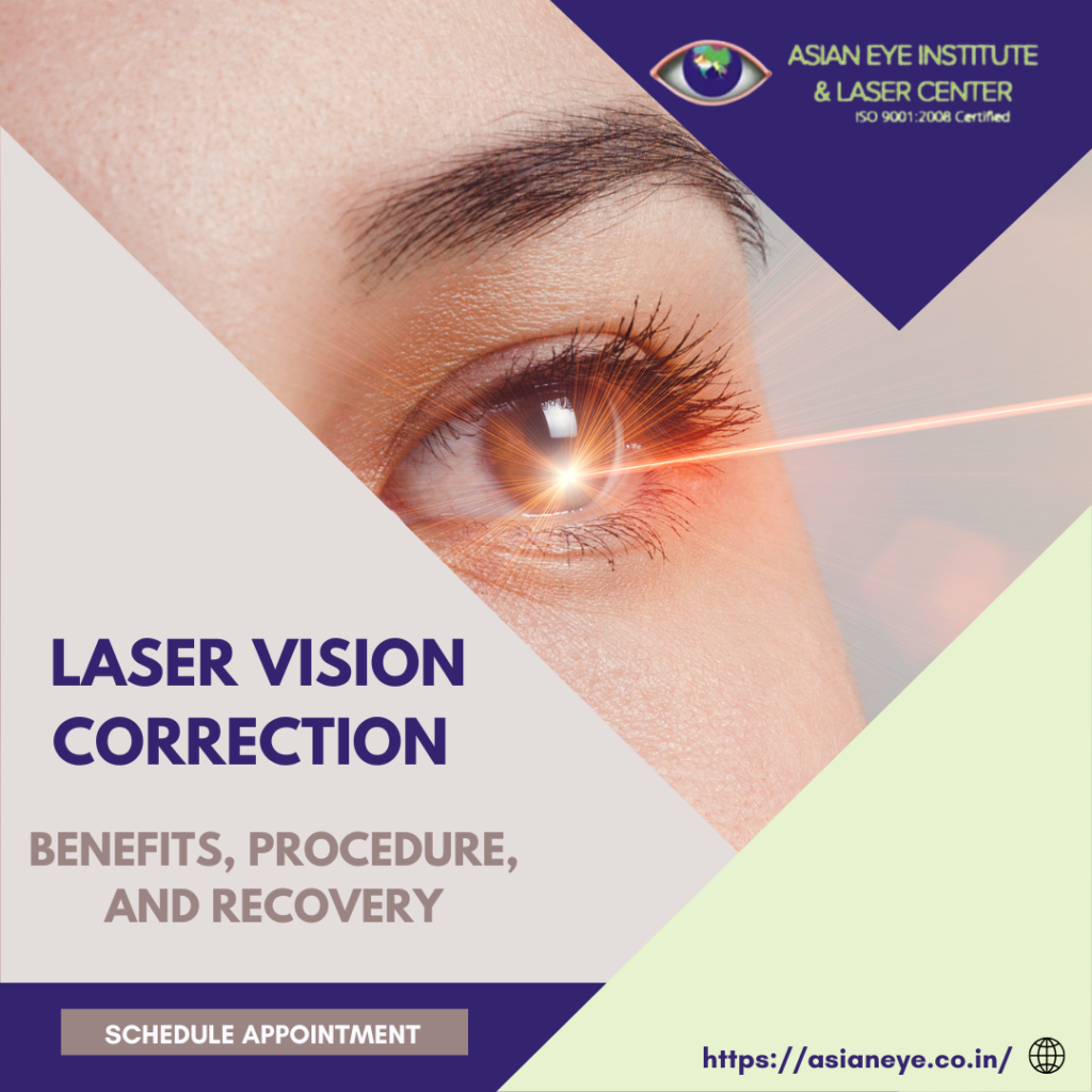 laser vision correction